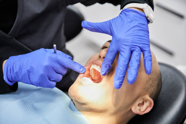 Best Chipped Tooth Repair Near Me  in Finneytown, OH